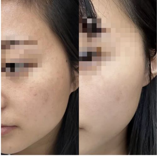 华评测：精选抗皱紧致精华重焕肌肤生机j9九游会俱乐部登录入口抗皱紧致精(图5)